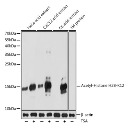 Western Blot - Anti-Histone H2B (acetyl Lys12) Antibody (A91510) - Antibodies.com