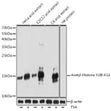 Western Blot - Anti-Histone H2B (acetyl Lys12) Antibody (A91510) - Antibodies.com