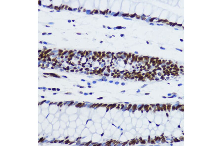 Immunohistochemistry - Anti-Histone H2B (acetyl Lys12) Antibody (A91510) - Antibodies.com