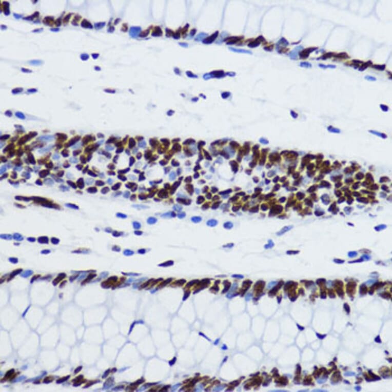 Immunohistochemistry - Anti-Histone H2B (acetyl Lys12) Antibody (A91510) - Antibodies.com