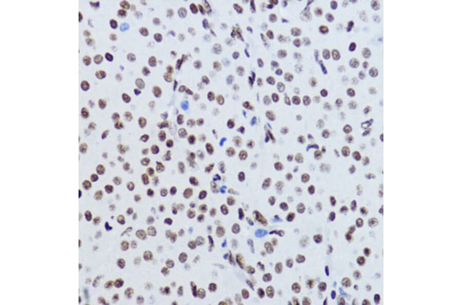 Immunohistochemistry - Anti-Histone H2B (acetyl Lys12) Antibody (A91510) - Antibodies.com