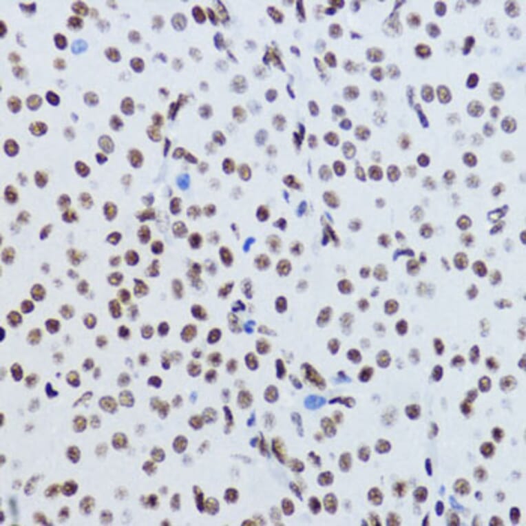 Immunohistochemistry - Anti-Histone H2B (acetyl Lys12) Antibody (A91510) - Antibodies.com