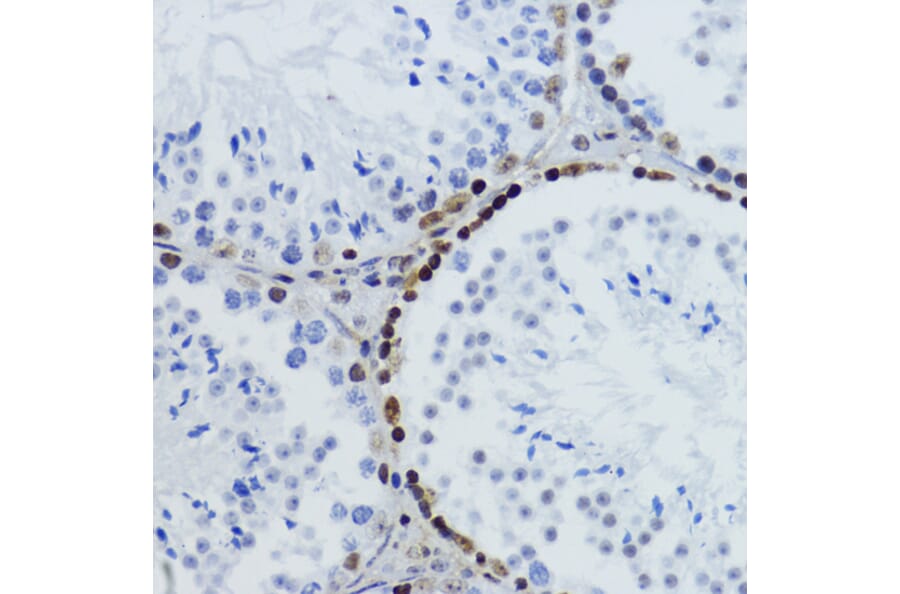 Immunohistochemistry - Anti-Histone H2B (acetyl Lys12) Antibody (A91510) - Antibodies.com