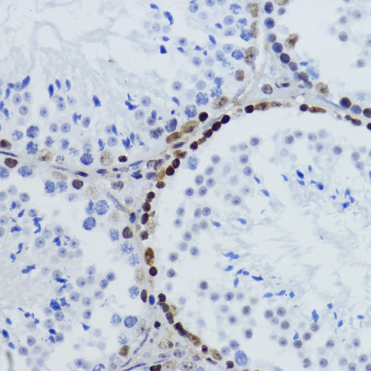 Immunohistochemistry - Anti-Histone H2B (acetyl Lys12) Antibody (A91510) - Antibodies.com