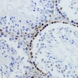 Immunohistochemistry - Anti-Histone H2B (acetyl Lys12) Antibody (A91510) - Antibodies.com