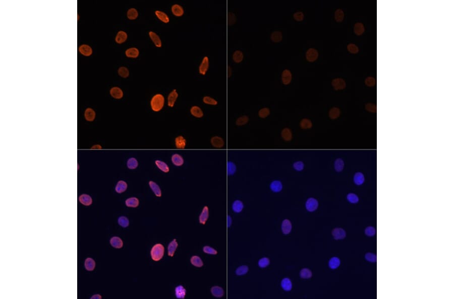 Immunofluorescence - Anti-Histone H2B (acetyl Lys12) Antibody (A91510) - Antibodies.com