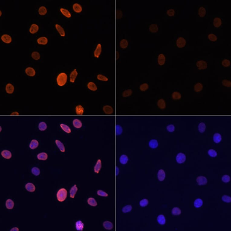 Immunofluorescence - Anti-Histone H2B (acetyl Lys12) Antibody (A91510) - Antibodies.com