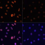 Immunofluorescence - Anti-Histone H2B (acetyl Lys12) Antibody (A91510) - Antibodies.com