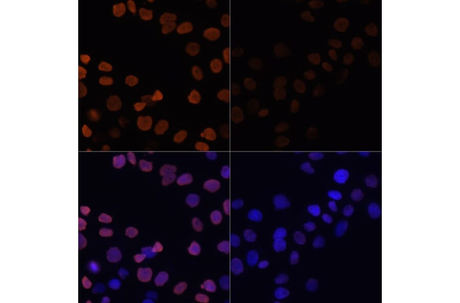 Immunofluorescence - Anti-Histone H2B (acetyl Lys12) Antibody (A91510) - Antibodies.com