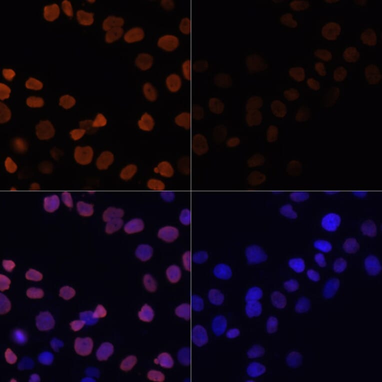 Immunofluorescence - Anti-Histone H2B (acetyl Lys12) Antibody (A91510) - Antibodies.com