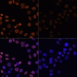 Immunofluorescence - Anti-Histone H2B (acetyl Lys12) Antibody (A91510) - Antibodies.com