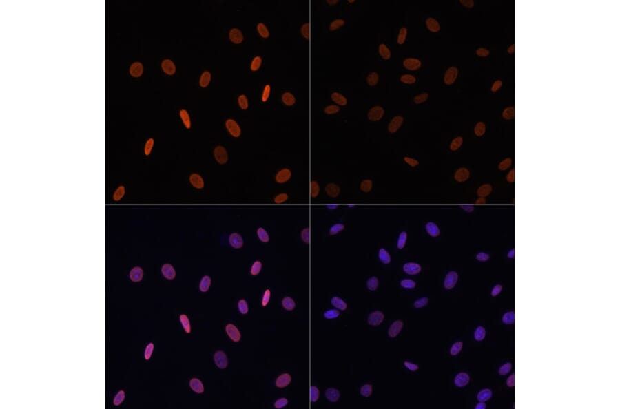 Immunofluorescence - Anti-Histone H2B (acetyl Lys12) Antibody (A91510) - Antibodies.com