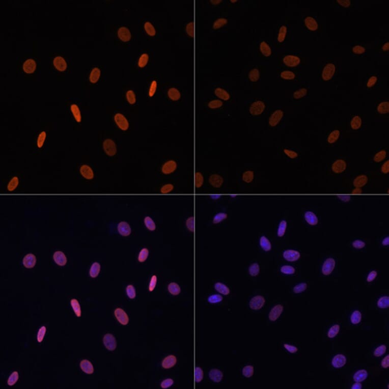 Immunofluorescence - Anti-Histone H2B (acetyl Lys12) Antibody (A91510) - Antibodies.com