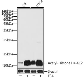 Western Blot - Anti-Histone H4 (acetyl Lys12) Antibody (A91511) - Antibodies.com