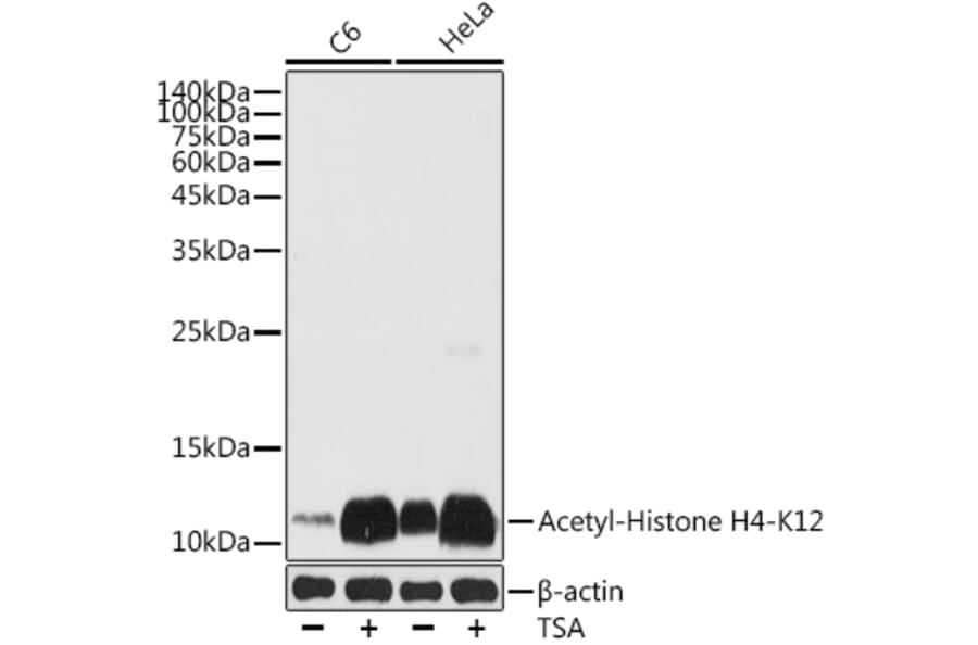 Western Blot - Anti-Histone H4 (acetyl Lys12) Antibody (A91511) - Antibodies.com