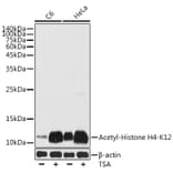 Western Blot - Anti-Histone H4 (acetyl Lys12) Antibody (A91511) - Antibodies.com