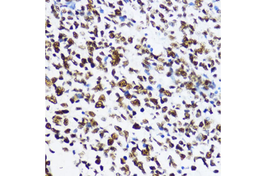 Immunohistochemistry - Anti-Histone H4 (acetyl Lys12) Antibody (A91511) - Antibodies.com