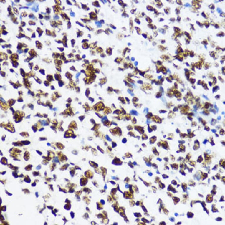 Immunohistochemistry - Anti-Histone H4 (acetyl Lys12) Antibody (A91511) - Antibodies.com