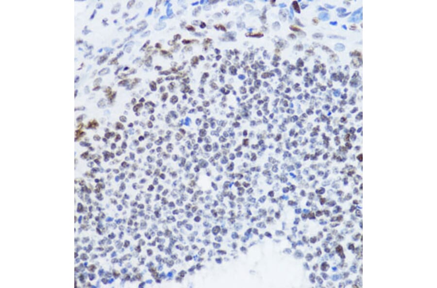 Immunohistochemistry - Anti-Histone H4 (acetyl Lys12) Antibody (A91511) - Antibodies.com