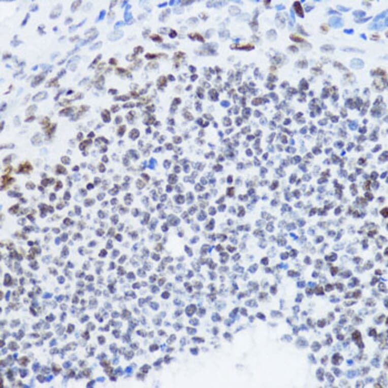 Immunohistochemistry - Anti-Histone H4 (acetyl Lys12) Antibody (A91511) - Antibodies.com