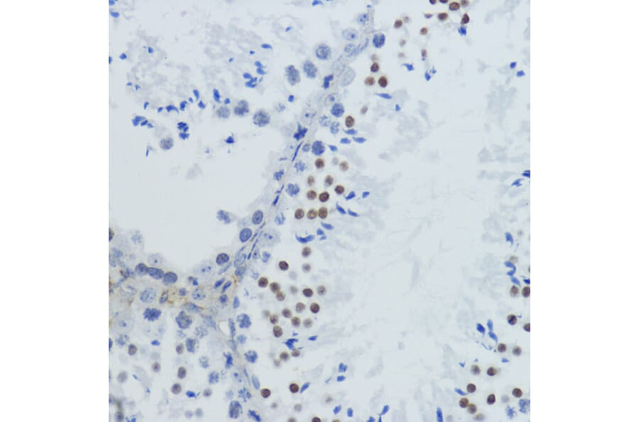 Immunohistochemistry - Anti-Histone H4 (acetyl Lys12) Antibody (A91511) - Antibodies.com