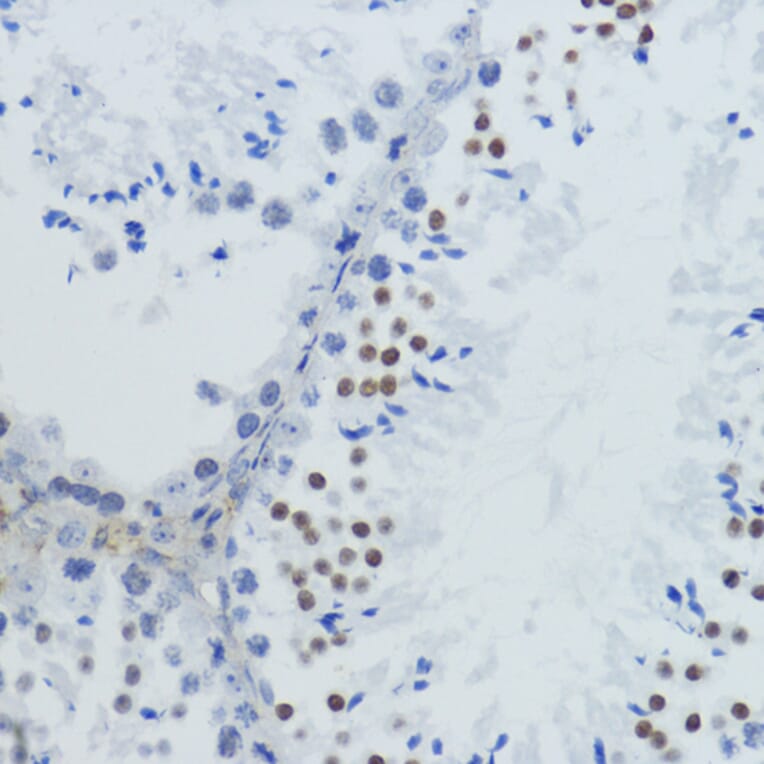 Immunohistochemistry - Anti-Histone H4 (acetyl Lys12) Antibody (A91511) - Antibodies.com