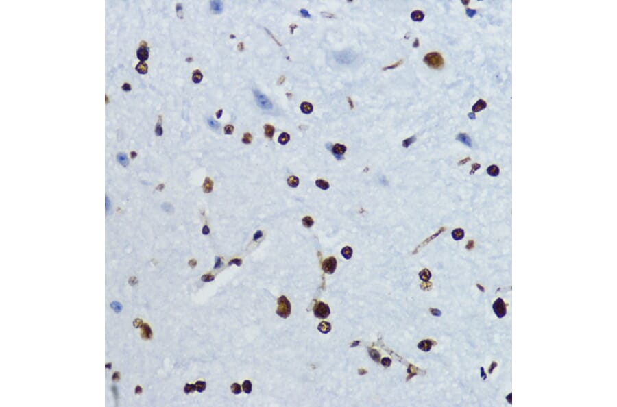 Immunohistochemistry - Anti-Histone H4 (acetyl Lys12) Antibody (A91511) - Antibodies.com