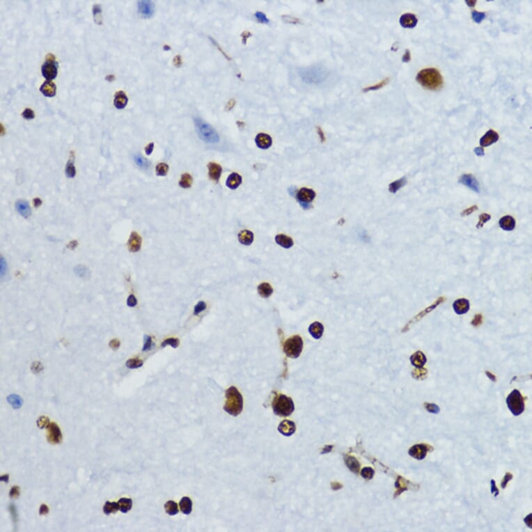 Immunohistochemistry - Anti-Histone H4 (acetyl Lys12) Antibody (A91511) - Antibodies.com