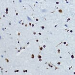 Immunohistochemistry - Anti-Histone H4 (acetyl Lys12) Antibody (A91511) - Antibodies.com