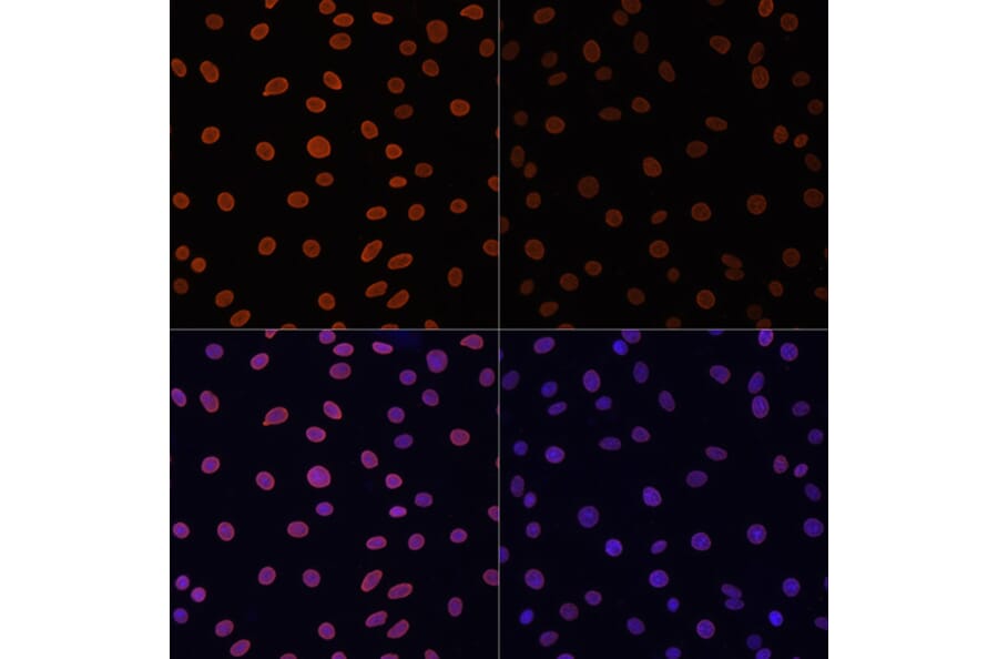 Immunofluorescence - Anti-Histone H4 (acetyl Lys12) Antibody (A91511) - Antibodies.com