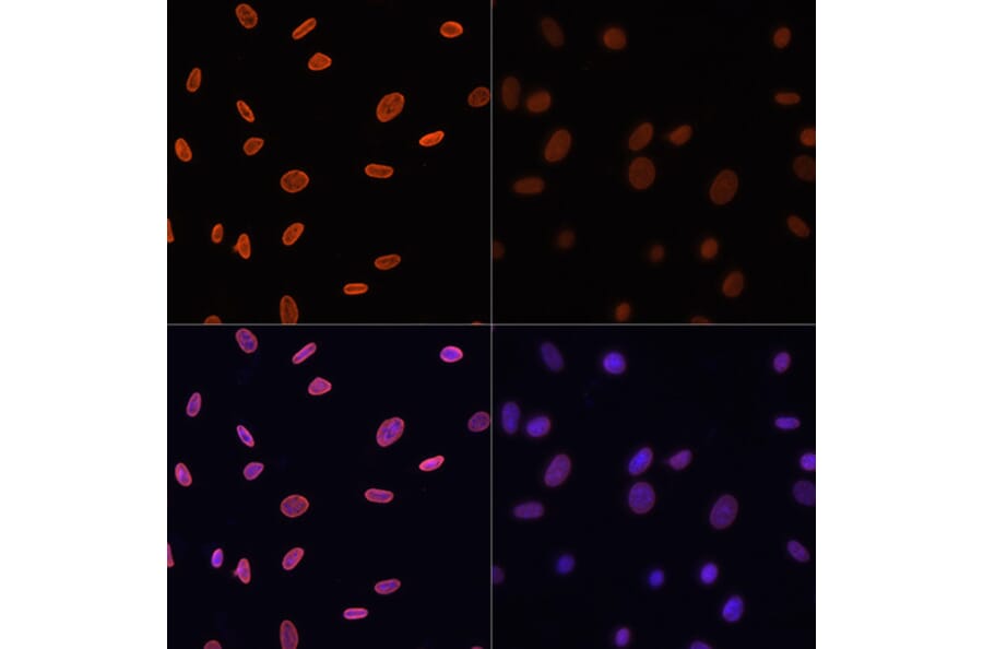 Immunofluorescence - Anti-Histone H4 (acetyl Lys12) Antibody (A91511) - Antibodies.com