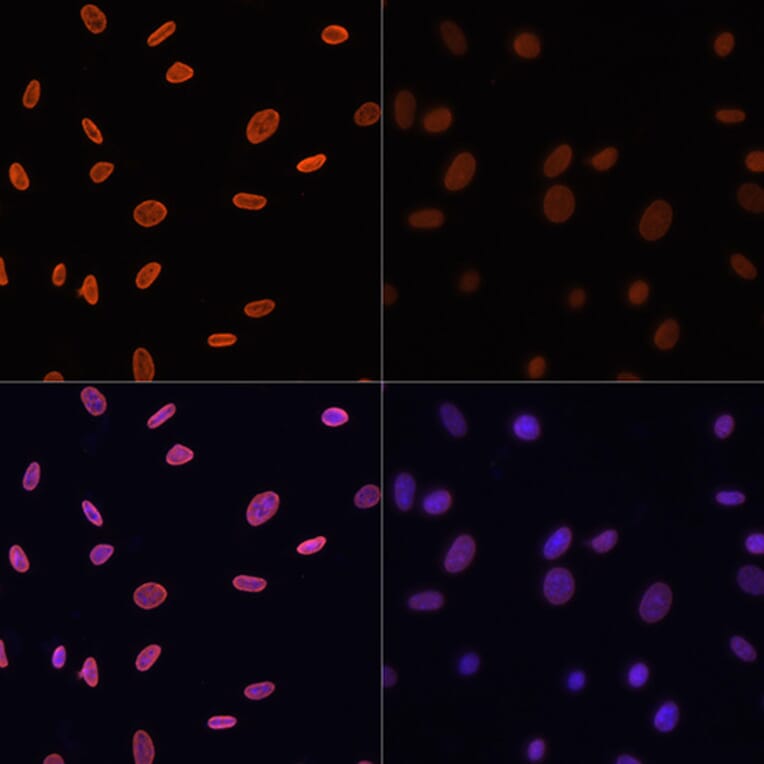 Immunofluorescence - Anti-Histone H4 (acetyl Lys12) Antibody (A91511) - Antibodies.com