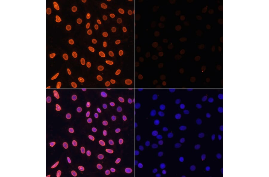 Immunofluorescence - Anti-Histone H3 (acetyl Lys36) Antibody (A91513) - Antibodies.com
