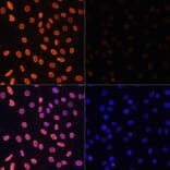 Immunofluorescence - Anti-Histone H3 (acetyl Lys36) Antibody (A91513) - Antibodies.com