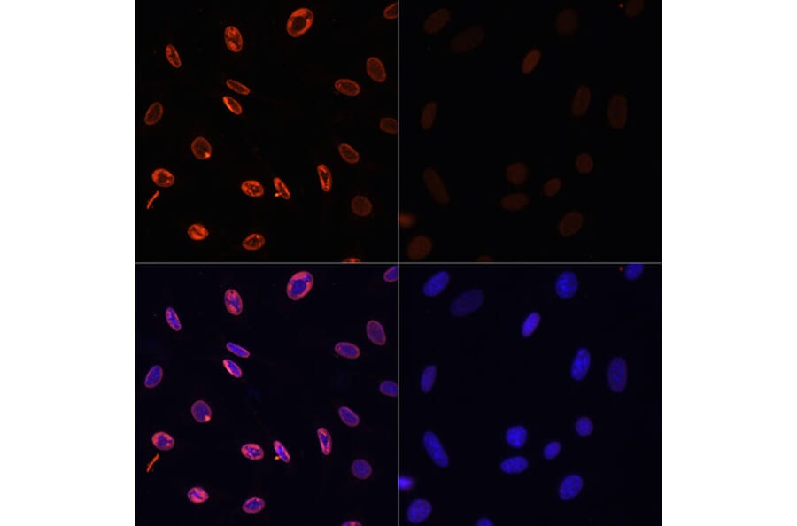Immunofluorescence - Anti-Histone H3 (acetyl Lys36) Antibody (A91513) - Antibodies.com