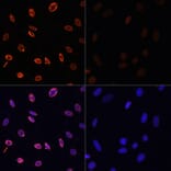 Immunofluorescence - Anti-Histone H3 (acetyl Lys36) Antibody (A91513) - Antibodies.com