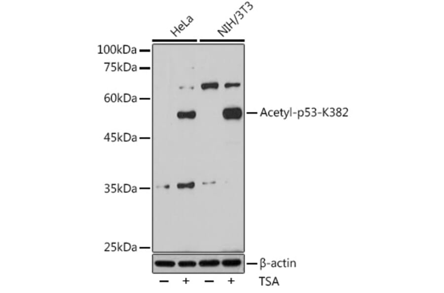 Western Blot - Anti-p53 (acetyl Lys382) Antibody (A91514) - Antibodies.com