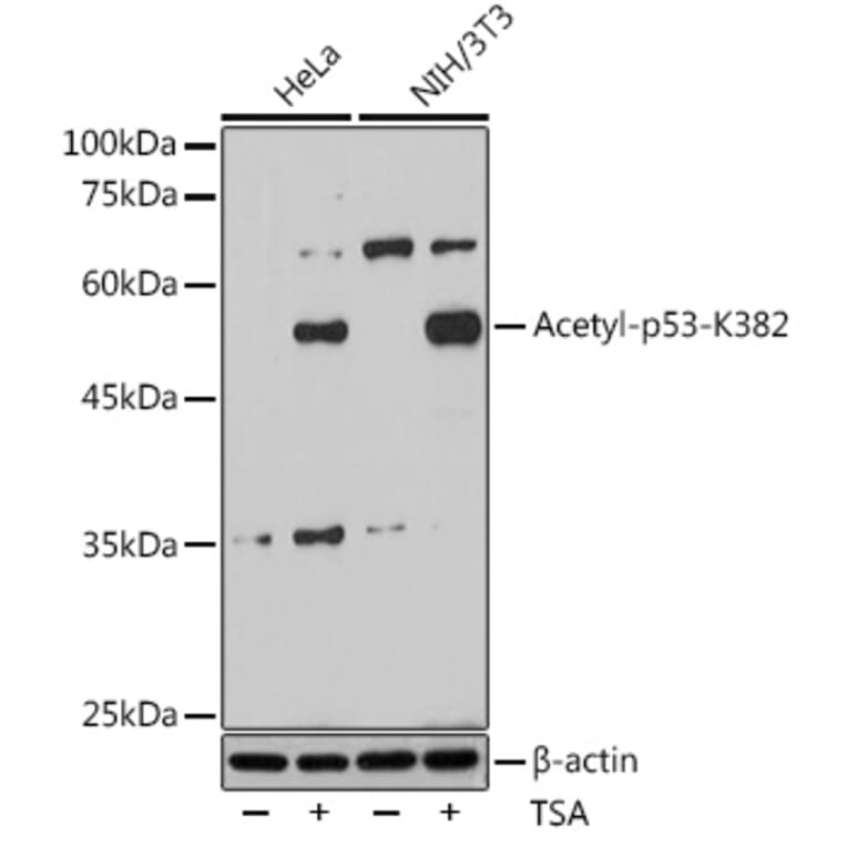 Western Blot - Anti-p53 (acetyl Lys382) Antibody (A91514) - Antibodies.com
