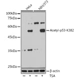 Western Blot - Anti-p53 (acetyl Lys382) Antibody (A91514) - Antibodies.com