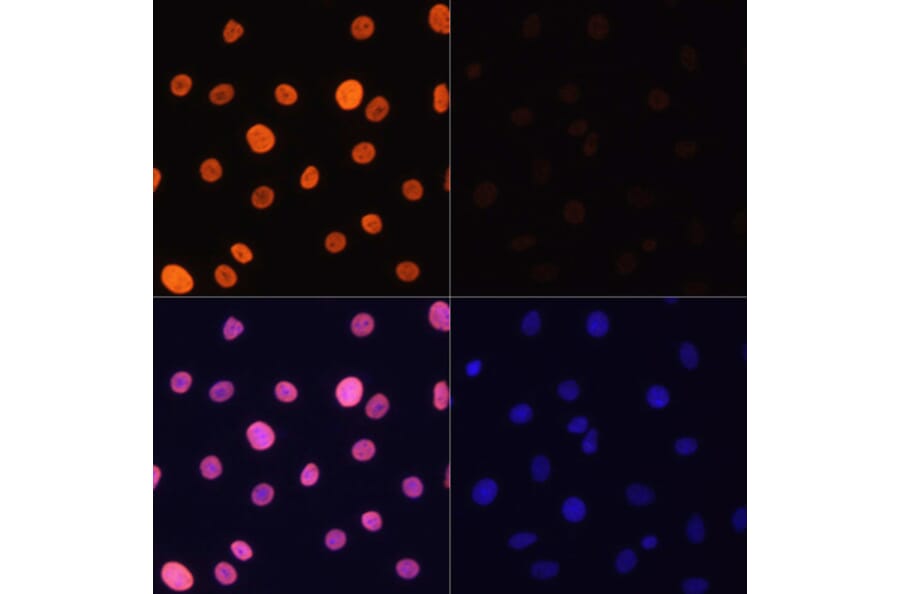 Immunofluorescence - Anti-Histone H3 (acetyl Lys4) Antibody (A91515) - Antibodies.com
