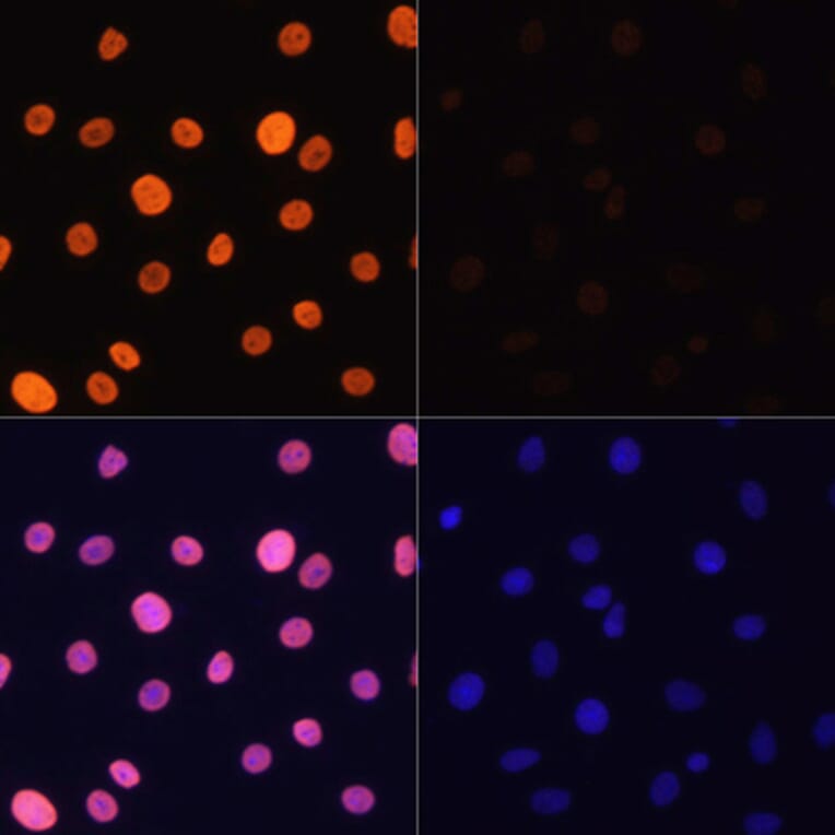 Immunofluorescence - Anti-Histone H3 (acetyl Lys4) Antibody (A91515) - Antibodies.com