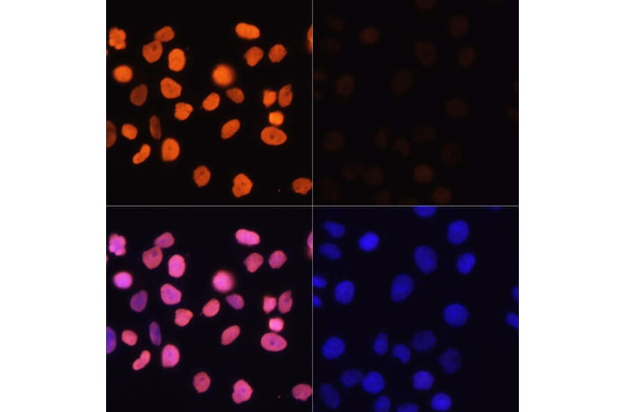 Immunofluorescence - Anti-Histone H3 (acetyl Lys4) Antibody (A91515) - Antibodies.com