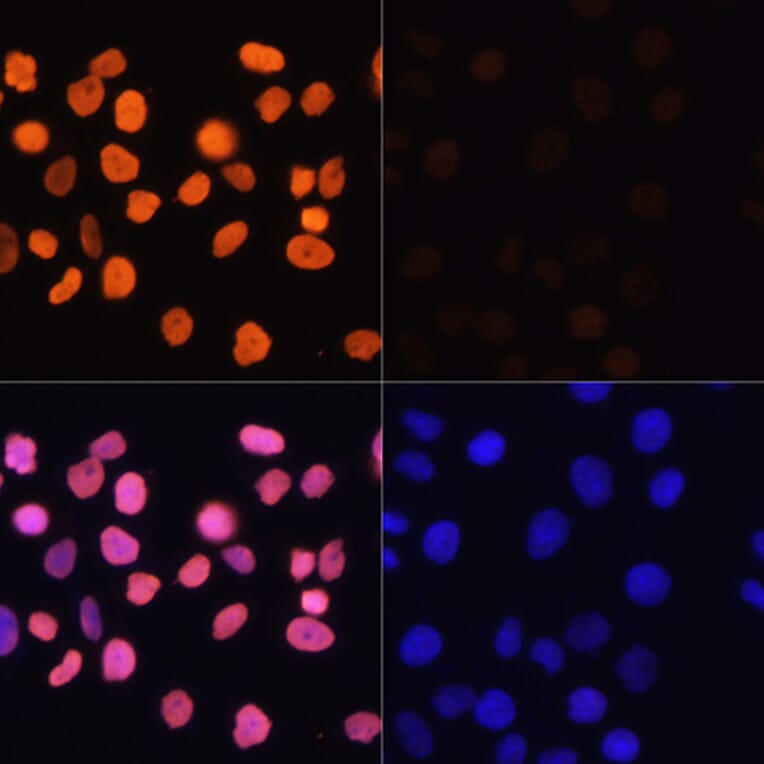 Immunofluorescence - Anti-Histone H3 (acetyl Lys4) Antibody (A91515) - Antibodies.com