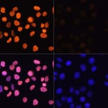 Immunofluorescence - Anti-Histone H3 (acetyl Lys4) Antibody (A91515) - Antibodies.com