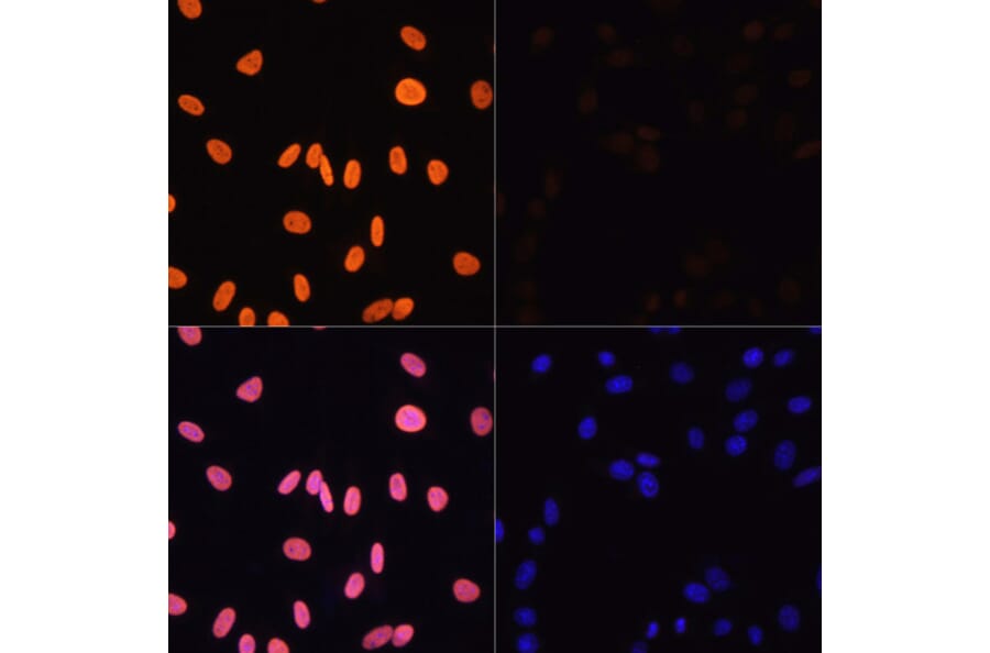 Immunofluorescence - Anti-Histone H3 (acetyl Lys4) Antibody (A91515) - Antibodies.com