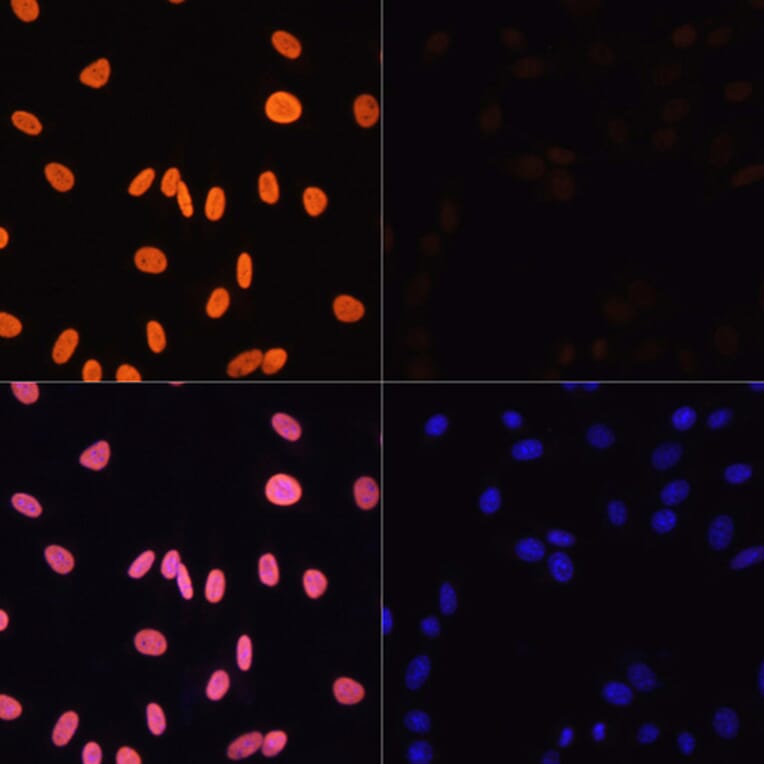 Immunofluorescence - Anti-Histone H3 (acetyl Lys4) Antibody (A91515) - Antibodies.com