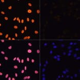 Immunofluorescence - Anti-Histone H3 (acetyl Lys4) Antibody (A91515) - Antibodies.com