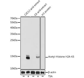Western Blot - Anti-Histone H2A (acetyl Lys5) Antibody (A91516) - Antibodies.com