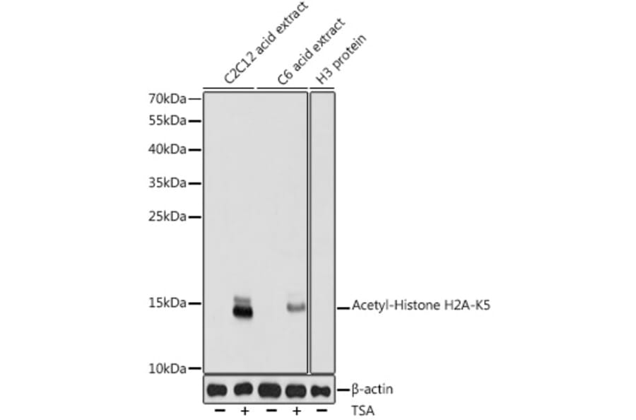 Western Blot - Anti-Histone H2A (acetyl Lys5) Antibody (A91516) - Antibodies.com