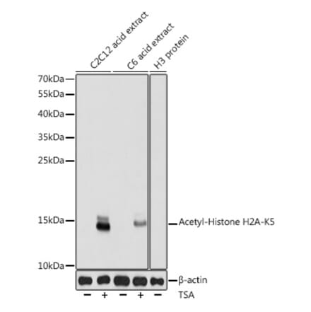 Western Blot - Anti-Histone H2A (acetyl Lys5) Antibody (A91516) - Antibodies.com